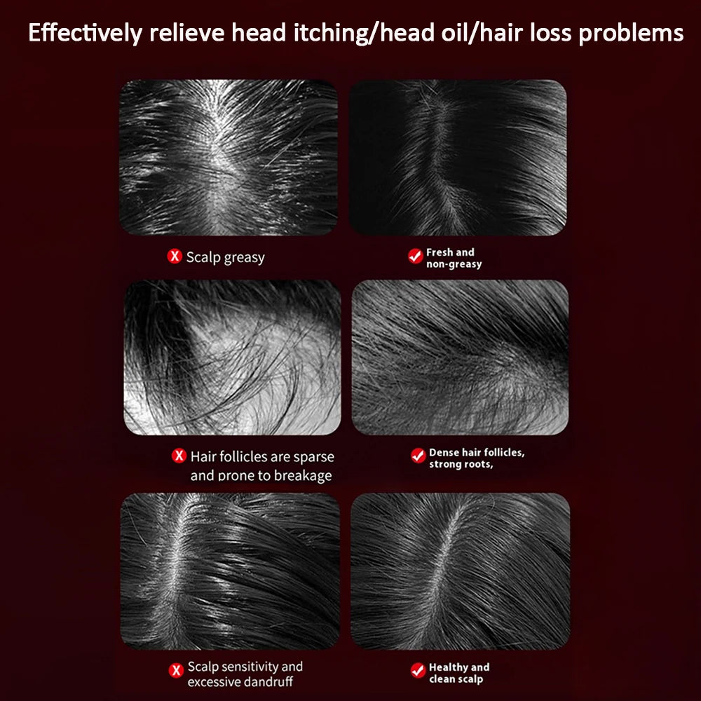 Hair Growth Massage Scalp