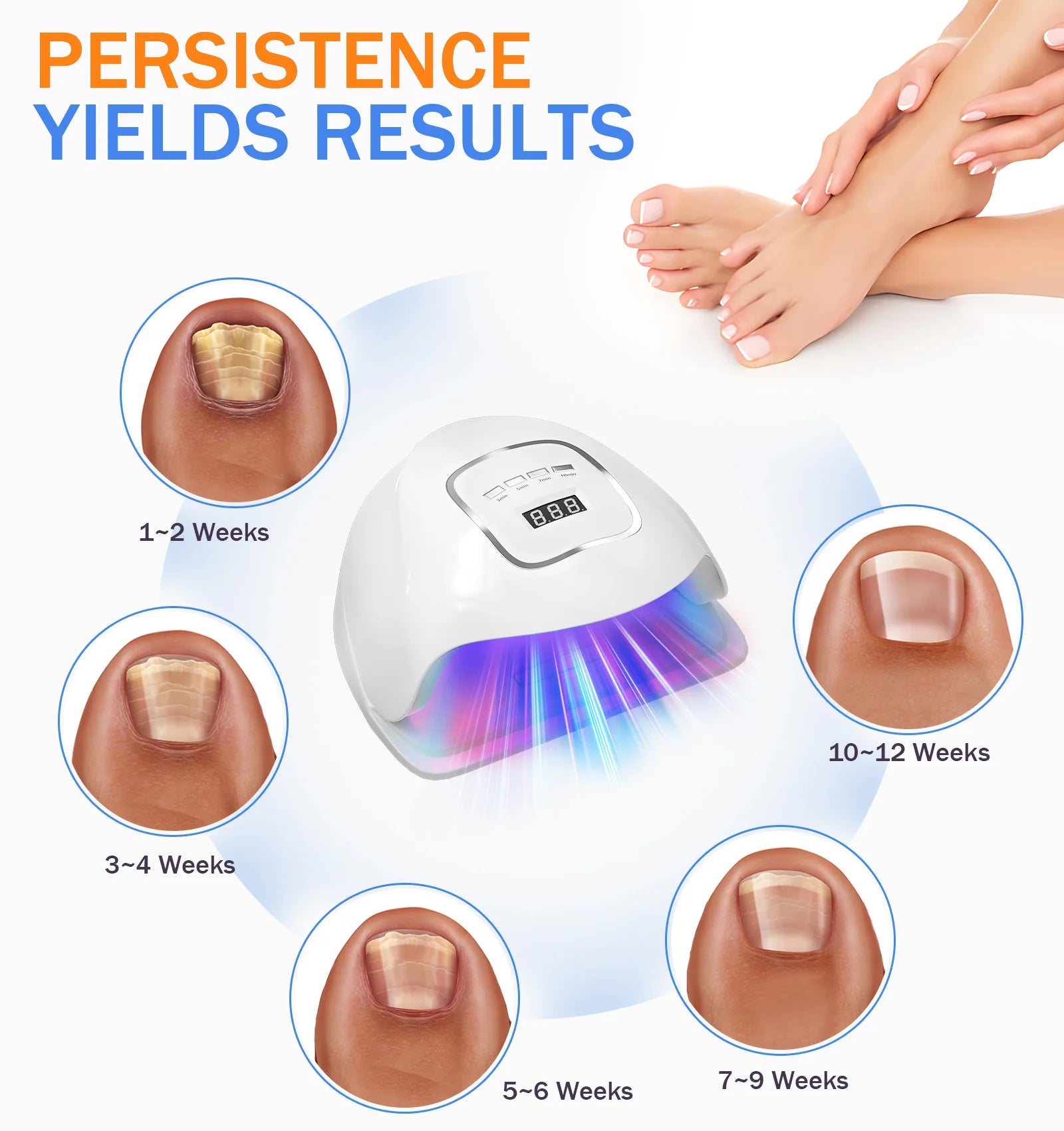 Nail Laser Fungus